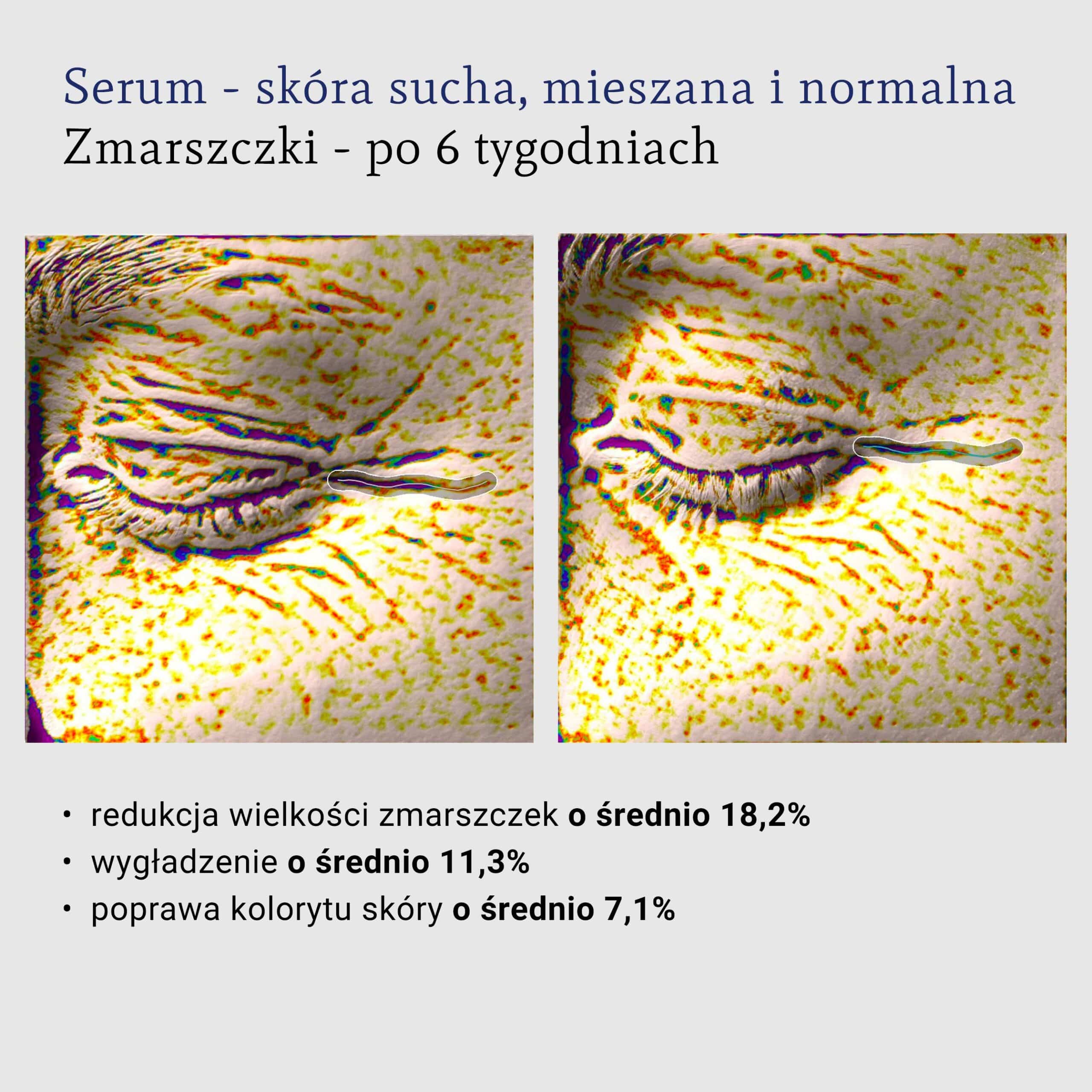 składniki aktywne w kosmetykach, działanie przeciwzmarszczkowe. Serum z Q10