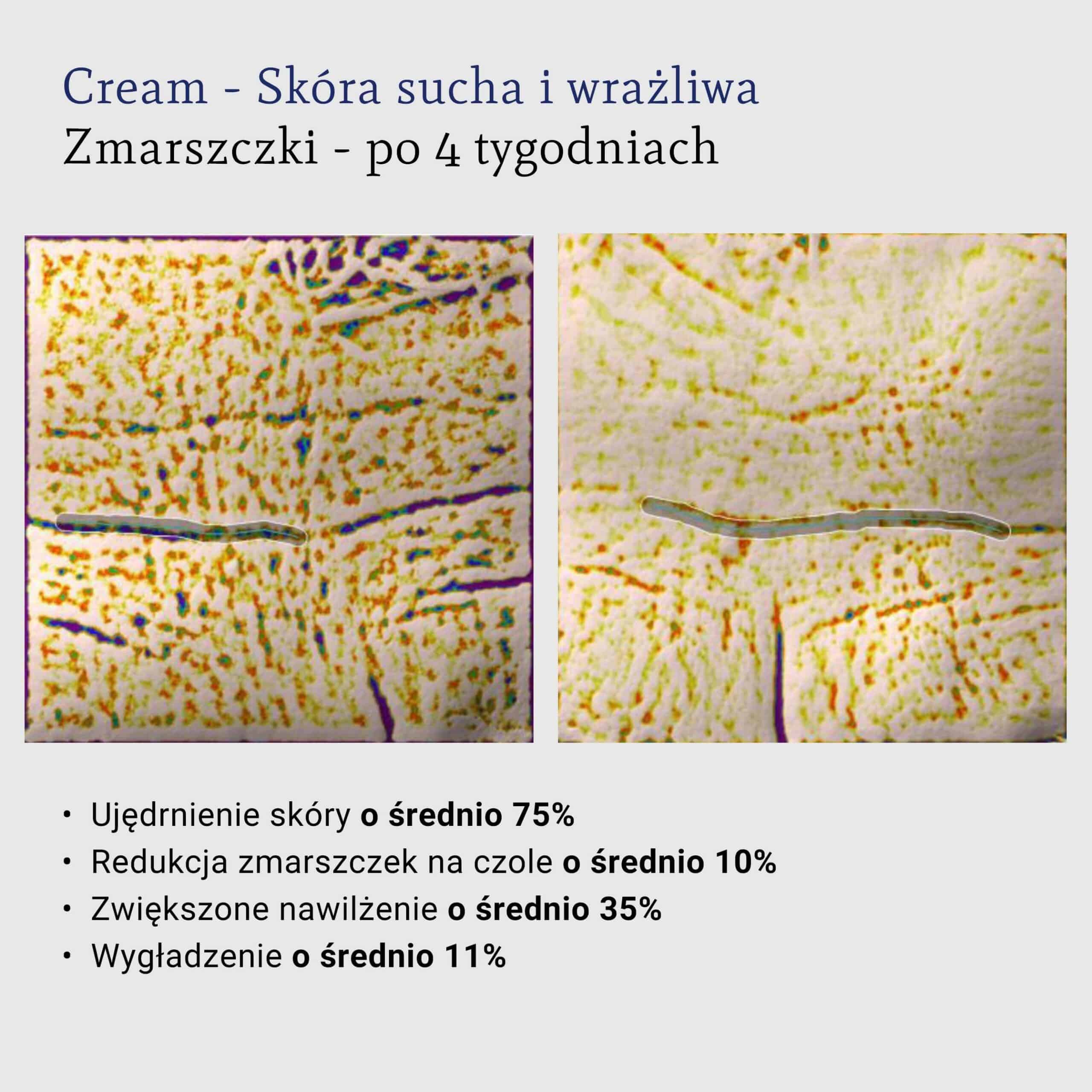 redukcja zmarszczek na czole, wygładzenie, badania kliniczne. składniki aktywne w kosmetykach