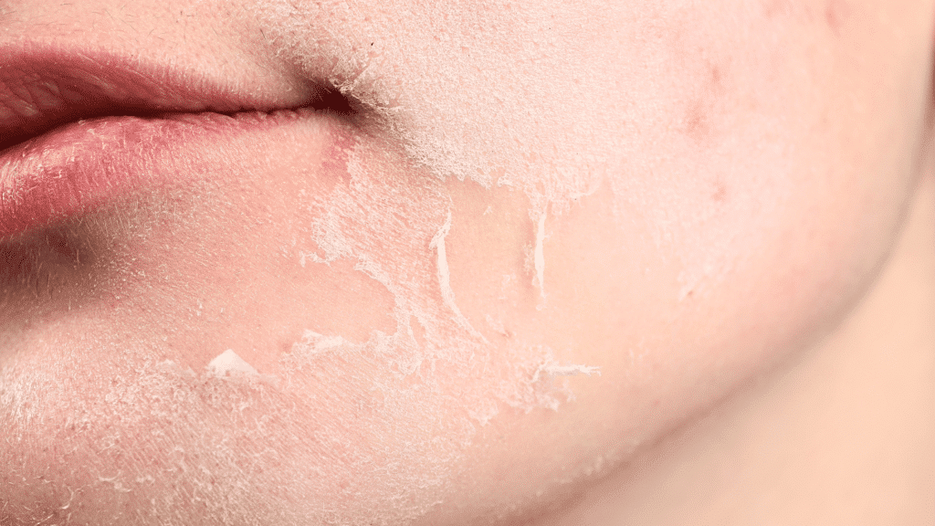 skóra ucha i wrażliwa pielęgnacja