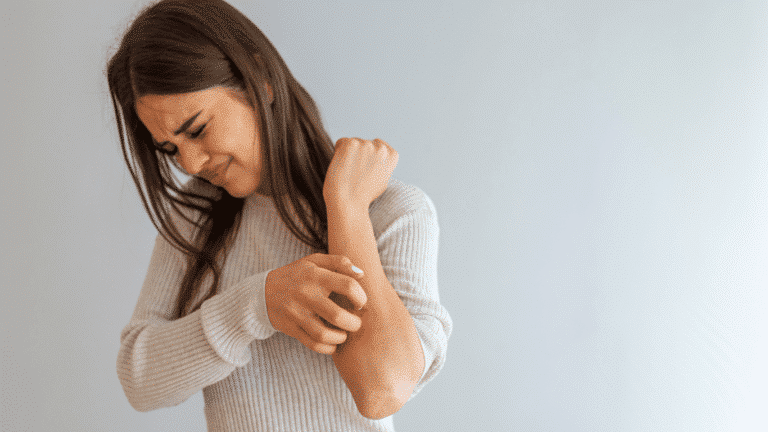 Atopowe zapalenie skóry objawy